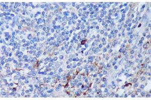 Immunohistochemistry of paraffin-embedded Human tonsil using PADI4 Polyclonal Antibody at dilution of 1:100 (40x lens). (PAD4 anticorps)