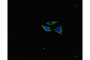 Immunofluorescent analysis of SH-SY5Y cells using ABIN7161278 at dilution of 1:100 and Alexa Fluor 488-congugated AffiniPure Goat Anti-Rabbit IgG(H+L) (NEFL anticorps  (AA 128-271))