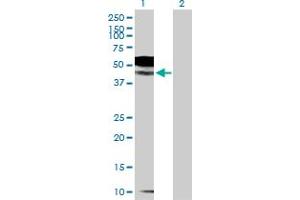 Western Blot analysis of IL1R2 expression in transfected 293T cell line by IL1R2 MaxPab polyclonal antibody. (IL1R2 anticorps  (AA 1-398))