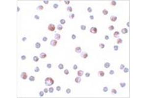 Immunocytochemistry of TCTN3 in HeLa cells with TCTN3 antibody at 4 μg/ml. (TCTN3 anticorps  (C-Term))