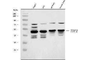 Western blot analysis of TDP2 using anti-TDP2 antibody (ABIN7600905). (TDP2 anticorps  (AA 25-332))