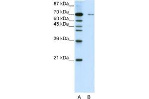 WB Suggested Anti-ZNF398 Antibody Titration:  0. (ZNF398 anticorps  (C-Term))