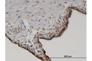 Immunoperoxidase of monoclonal antibody to PPM1A on formalin-fixed paraffin-embedded human placenta.