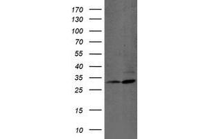 Western Blotting (WB) image for anti-Proteasome (Prosome, Macropain) Subunit, beta Type, 7 (PSMB7) (AA 58-277) antibody (ABIN1491599) (PSMB7 anticorps  (AA 58-277))