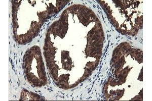 Image no. 5 for anti-Mannose Phosphate Isomerase (MPI) antibody (ABIN1499543)