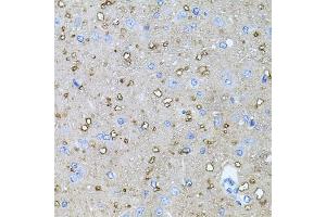 Immunohistochemistry of paraffin-embedded rat brain using NTF4 antibody (ABIN3021387, ABIN3021388, ABIN3021389 and ABIN6214994) at dilution of 1:100 (40x lens).