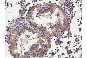 Image no. 12 for anti-COBW Domain Containing 1 (CBWD1) antibody (ABIN1497117) (CBWD1 anticorps)