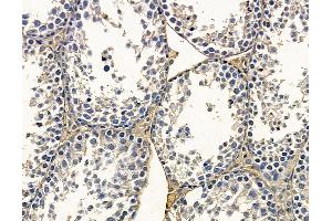 ABIN7095167 and ABIN7099223 at 1/100 staining mouse testis tissue by IHC-P. (FBXL7 anticorps)