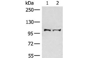 Western blot analysis of Mouse brain tissue and Jurkat cell lysates using EFTUD2 Polyclonal Antibody at dilution of 1:550
