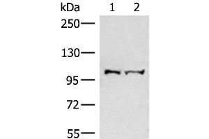Western blot analysis of Mouse brain tissue and Jurkat cell lysates using EFTUD2 Polyclonal Antibody at dilution of 1:550 (EFTUD2 anticorps)
