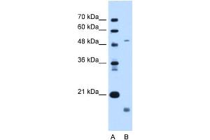 WB Suggested Anti-ZMPSTE24 Antibody Titration:  0. (ZMPSTE24 anticorps  (N-Term))