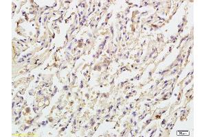 Formalin-fixed and paraffin embedded human endometrial tissue labeled with Anti Caspase-9 p10 Polyclonal Antibody, Unconjugated (ABIN1387603) at 1:200 followed by conjugation to the secondary antibody and DAB staining (Caspase 9 anticorps  (AA 351-416))