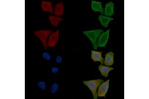 ABIN6264935 and ABIN6276742 staining Hela cells(30 min of UV treatment) by IF/ICC. (SCARB1 anticorps  (Internal Region))