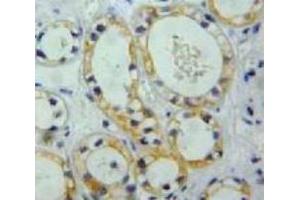 IHC-P analysis of Kidney tissue, with DAB staining. (Nephrin anticorps  (AA 39-144))