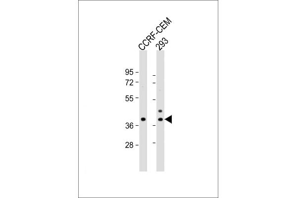 CCDC122 anticorps  (C-Term)