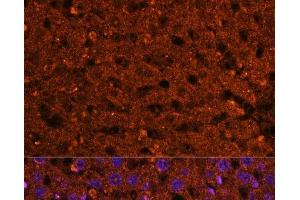 Immunofluorescence analysis of Rat liver using HMGCS2 Polyclonal Antibody at dilution of 1:100 (40x lens). (HMGCS2 anticorps)