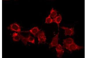 ABIN6278577 staining Hela by IF/ICC. (HCN2 anticorps  (Internal Region))