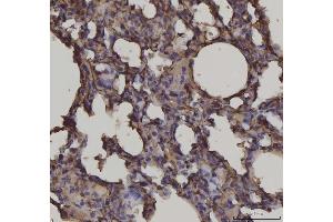 IHC analysis of RAGE/AGER using anti-RAGE/AGER antibody (ABIN7603153).