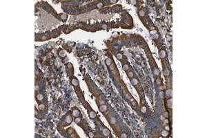 Immunohistochemical staining of human duodenum with CNPY3 polyclonal antibody  shows strong cytoplasmic positivity in glandular cells at 1:200-1:500 dilution. (TNRC5 anticorps)