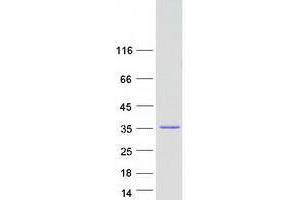 Validation with Western Blot