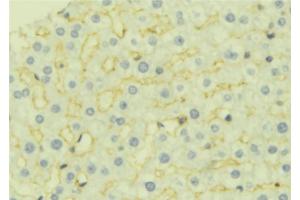 ABIN6277044 at 1/100 staining Mouse liver tissue by IHC-P. (AK4 anticorps  (Internal Region))