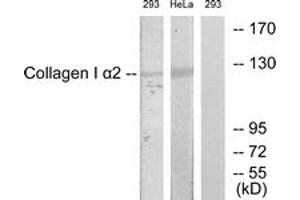 Western blot analysis of extracts from 293/HeLa cells, using Collagen I alpha2 Antibody. (COL1A2 anticorps  (AA 471-520))