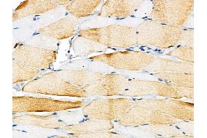 Phospho-NFAT3 (Ser676) Antibody at 1/100 staining Rat ovarian tissue by IHC-P.