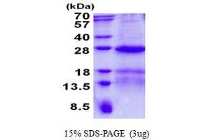 Nucleolar Protein 16 (NOP16) (AA 1-178) protein (His tag)