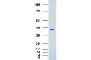 Validation with Western Blot