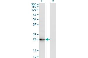 Western Blot analysis of COMMD1 expression in transfected 293T cell line by COMMD1 monoclonal antibody (M03), clone 2B12. (COMMD1 anticorps  (AA 1-190))