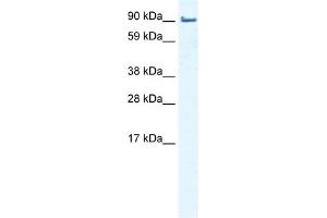 WB Suggested Anti-EPLIN Antibody Titration:  0.