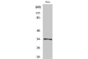 Western Blotting (WB) image for anti-Cyclin-Dependent Kinase 1 (CDK1) (pThr161) antibody (ABIN3179406) (CDK1 anticorps  (pThr161))