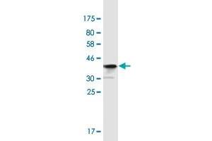 Western Blot detection against Immunogen (36. (PLRG1 anticorps  (AA 101-198))