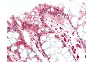 Human, Colon: Formalin-Fixed Paraffin-Embedded (FFPE).