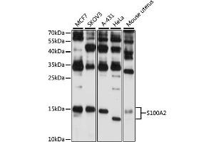 Western blot analysis of extracts of various cell lines, using S100 antibody (ABIN6128692, ABIN6147343, ABIN6147344 and ABIN6216356) at 1:3000 dilution. (S100A2 anticorps  (AA 1-97))