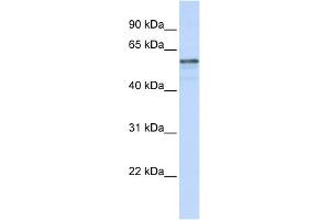WB Suggested Anti-TMEM195 Antibody Titration:  0. (TMEM195 anticorps  (N-Term))
