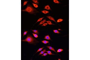 Immunofluorescence analysis of PC-12 cells using SERPIN antibody  at dilution of 1:100 (40x lens).