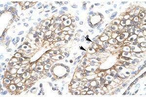 Human kidney; FLJ11730 antibody - N-terminal region in Human kidney cells using Immunohistochemistry