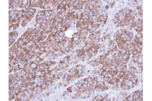 anti-Actinin, alpha 1 (ACTN1) antibody