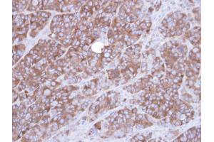 IHC-P Image Immunohistochemical analysis of paraffin-embedded SW480 xenograft , using Alpha-actinin 1, antibody at 1:100 dilution. (ACTN1 anticorps)