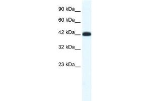 WB Suggested Anti-SLC2A4RG Antibody Titration: 0. (SLC2A4RG anticorps  (Middle Region))