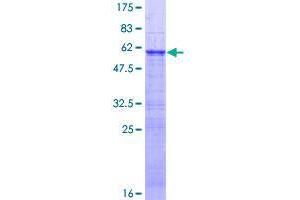 Image no. 1 for Zinc Finger Protein 509 (ZBTB49) (AA 1-248) protein (GST tag) (ABIN1326251)