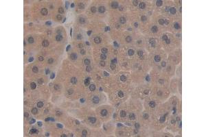 IHC-P analysis of liver tissue, with DAB staining. (TAT anticorps  (AA 190-454))