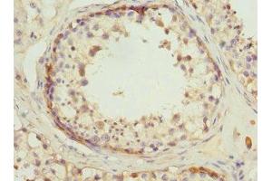 Immunohistochemistry of paraffin-embedded human testis tissue using ABIN7142076 at dilution of 1:100 (RDH5 anticorps  (AA 24-318))
