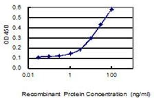 Detection limit for recombinant GST tagged SERTAD4 is 0. (SERTAD4 anticorps  (AA 1-356))