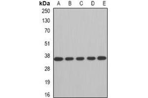 Western blot analysis of AUH expression in A549 (A), SW480 (B), mouse brain (C), mouse kidney (D), rat heart (E) whole cell lysates. (AUH anticorps)