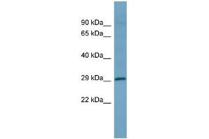 WB Suggested Anti-HOXD1 Antibody Titration: 0. (HOXD1 anticorps  (Middle Region))