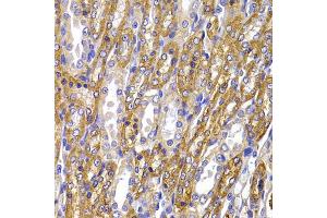 Immunohistochemistry of paraffin-embedded rat kidney using ATP1A1 antibody (ABIN5995394) at dilution of 1/100 (40x lens). (ATP1A1 anticorps)
