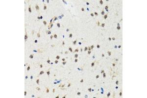 Immunohistochemistry of paraffin-embedded rat brain using CHUK antibody.