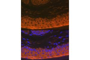Immunofluorescence analysis of rat skin using Cytokeratin 16 (KRT16) Rabbit mAb (ABIN7268094) at dilution of 1:100 (40x lens). (KRT16 anticorps)